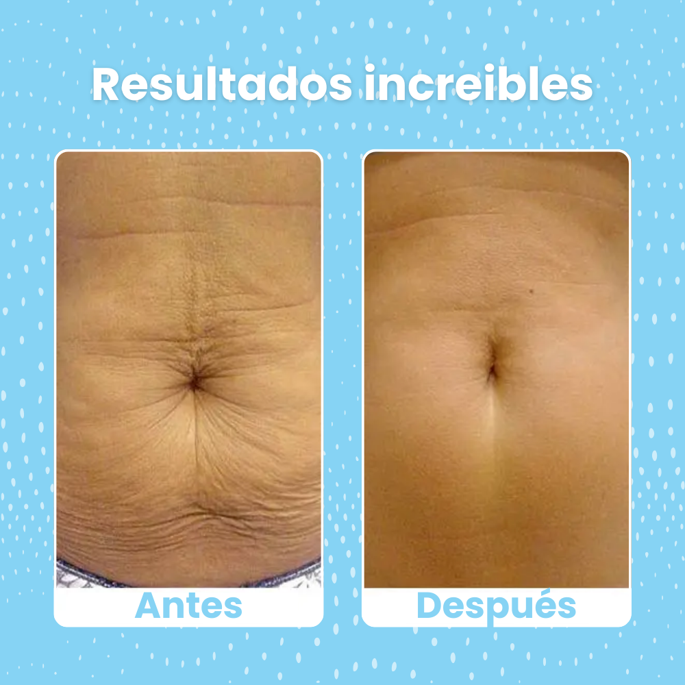 OCEAURA™ | DILE ADIÓS A LA PIEL FLÁCIDA Y SECA EN TAN SOLO 7 DÍAS